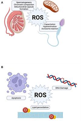 Oxidative Stress and Male Infertility: Evidence From a Research Perspective